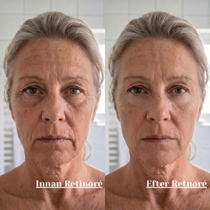 Retinorè - Renewal Cream.